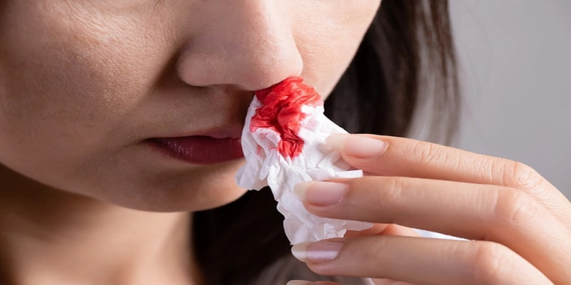 Mơ thấy chảy máu mũi nghĩa là áp lực tinh thần lớn